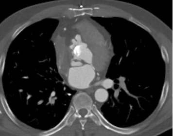Clinical Case