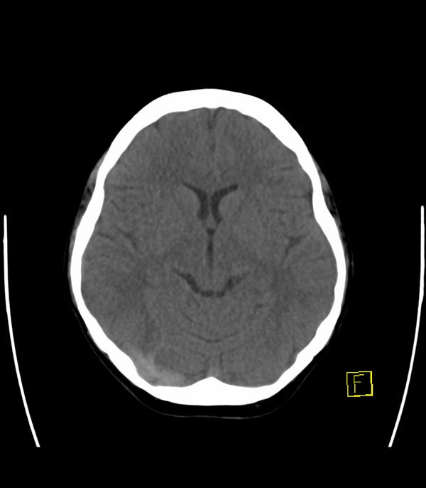 Clinical Case