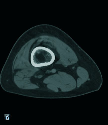 Clinical Case