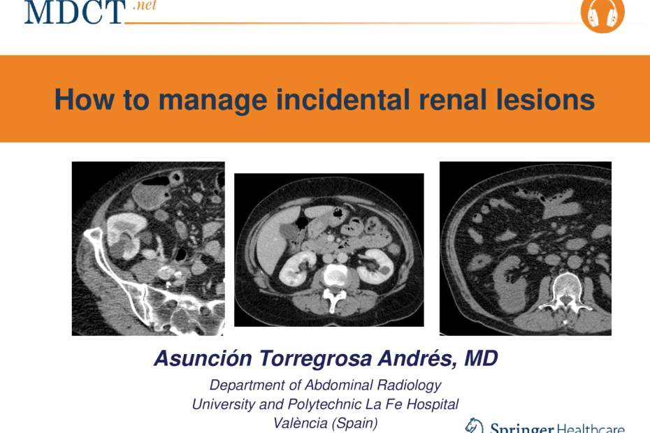 How to manage incidental renal lesions
