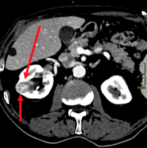 Arterial phase