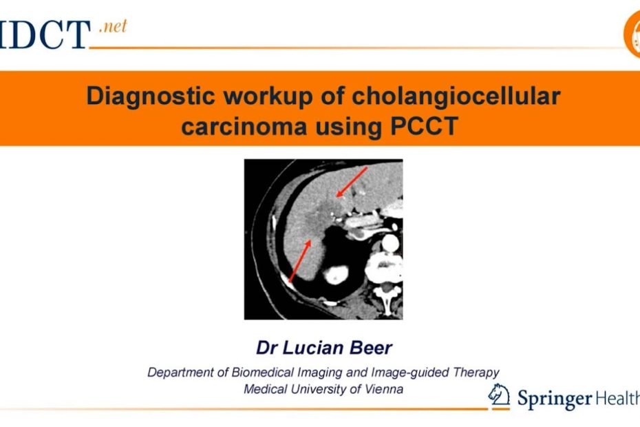 PCCT in the diagnosis of Intrahepatic Cholangiocellular Carcinoma