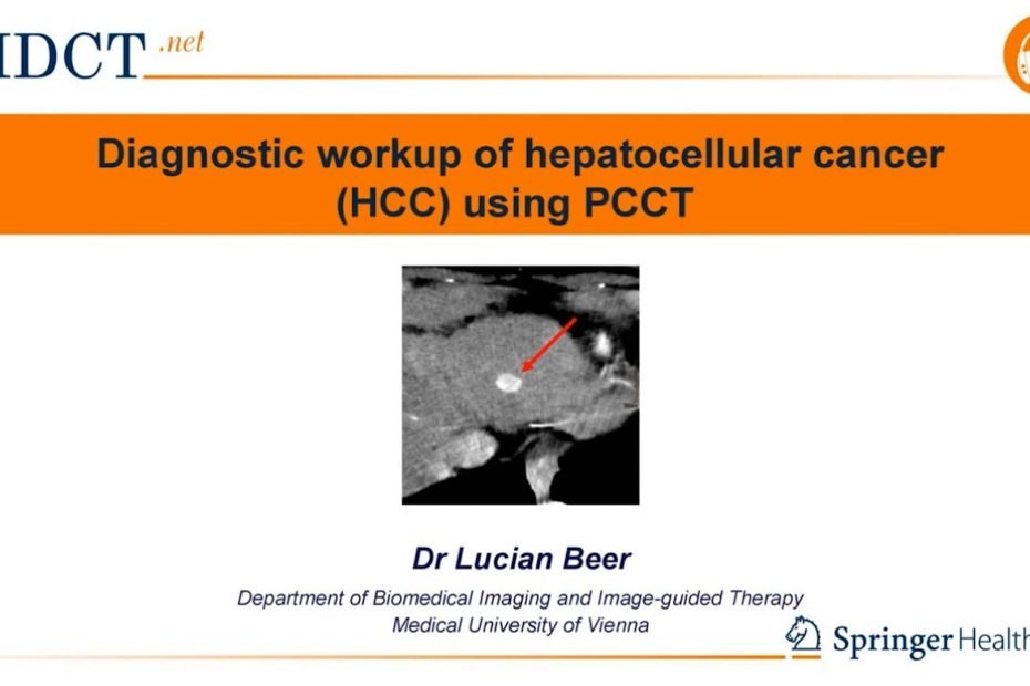 PCCT in the diagnosis of Hepatocellular Carcinoma