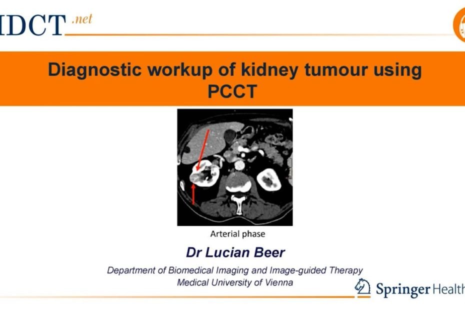 PCCT in the diagnosis of Clear Cell Renal Cell Carcinoma