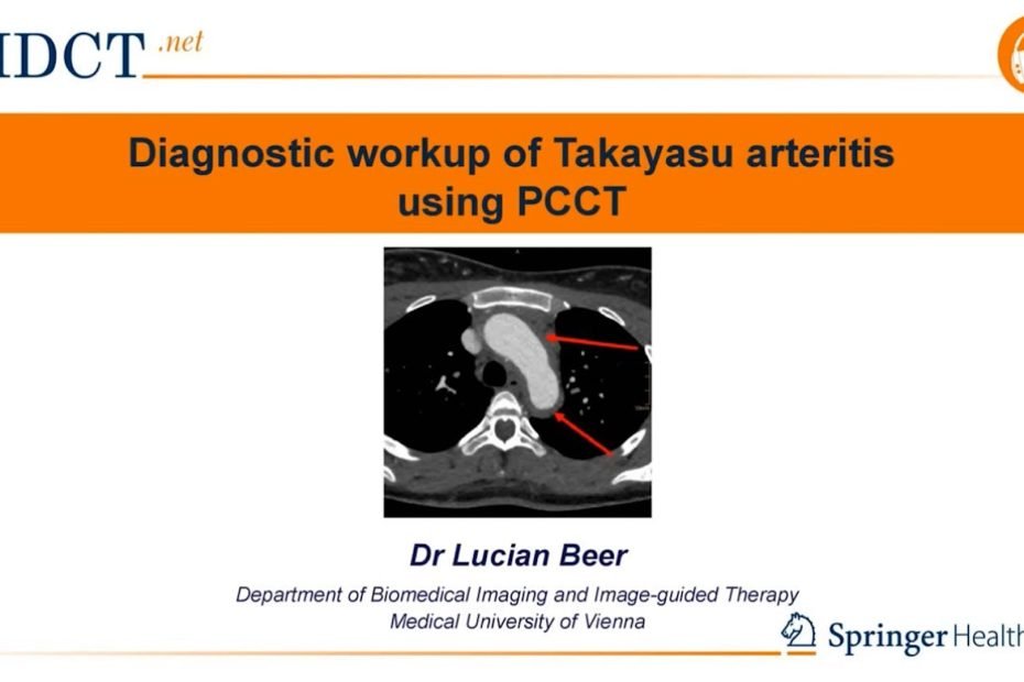 PCCT in the diagnosis of the Takayasu arteritis
