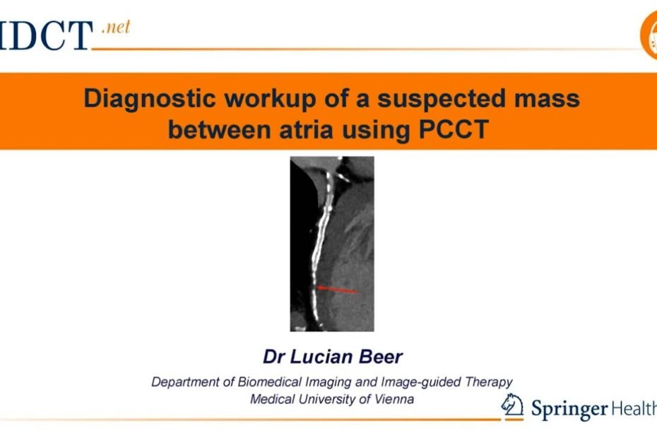 In this videopill, Dr. Lucian Beer discusses the case of a 72-year-old patient referred for evaluation of a suspected mass between the atria. The case highlights how PCCT clarifies the lesion’s nature, location, and tissue characteristics, enabling accurate differentiation from thrombus or tumor and guiding appropriate clinical management.