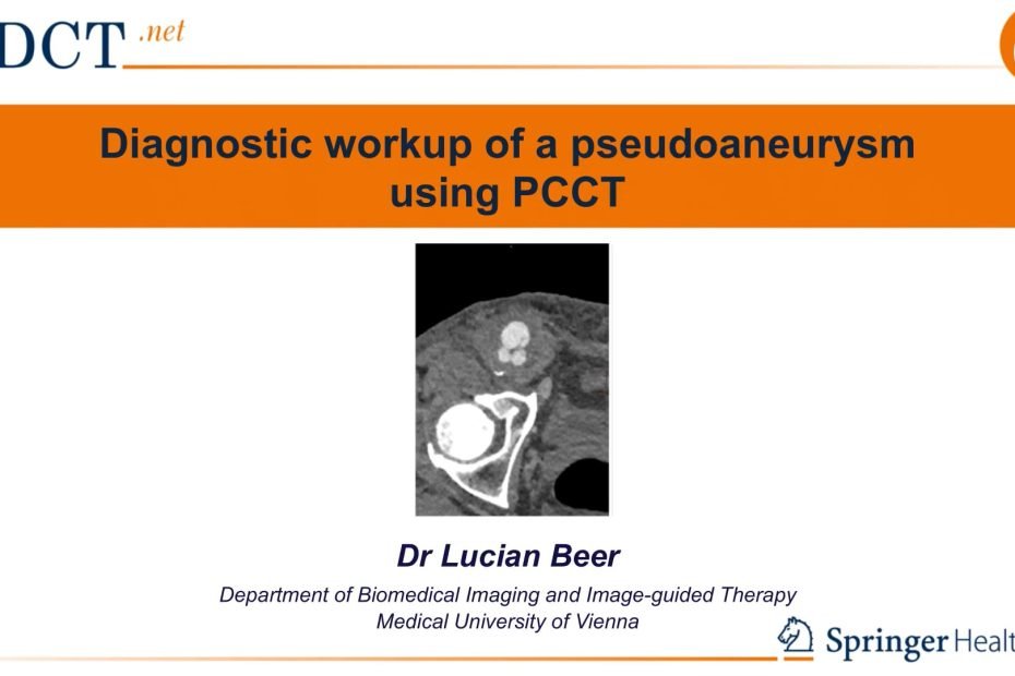 PCCT in the diagnosis of a complex pseudoaneurysm