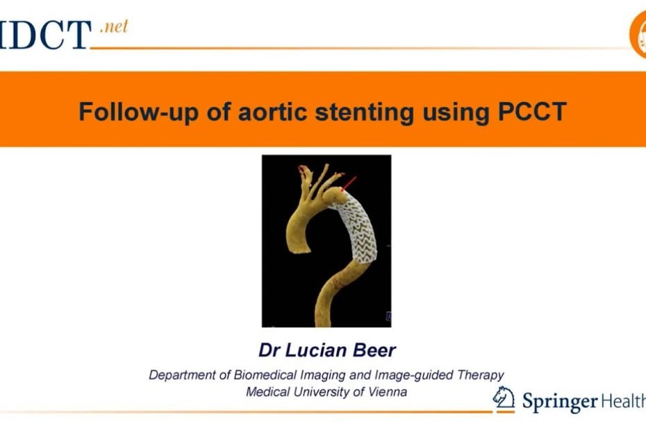 PCCT in the follow-up of aortal stenting (1)