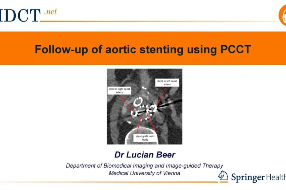 PCCT in the follow-up of aortal stenting (2)