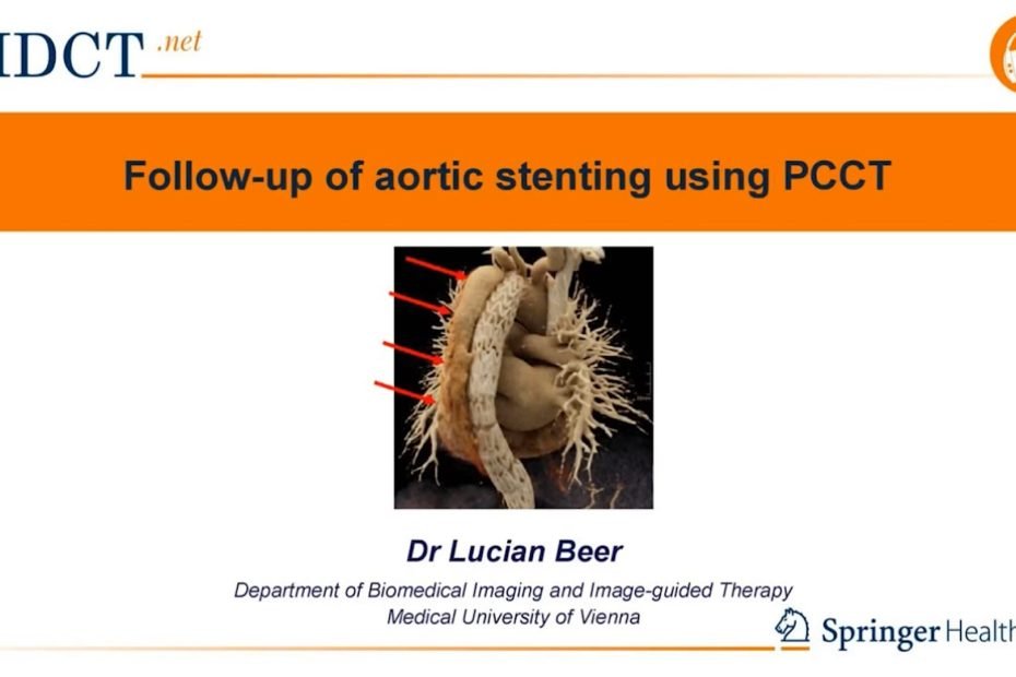 PCCT in the follow-up of aortal stenting (3)