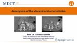 Contrast-enhanced CT angiography showing a visceral artery aneurysm used for diagnosis and therapeutic planning