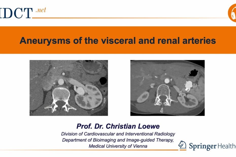 Contrast-enhanced CT angiography showing a visceral artery aneurysm used for diagnosis and therapeutic planning